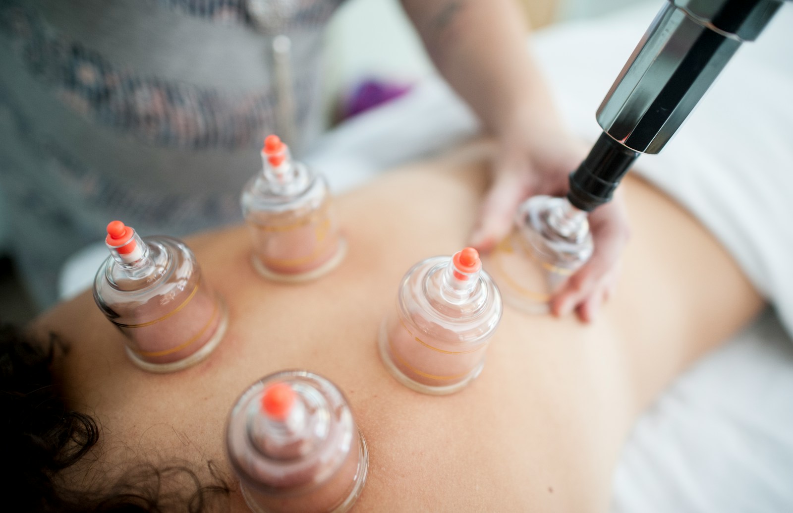 Ontspannende en herstellende effecten van cupping in Amsterdam